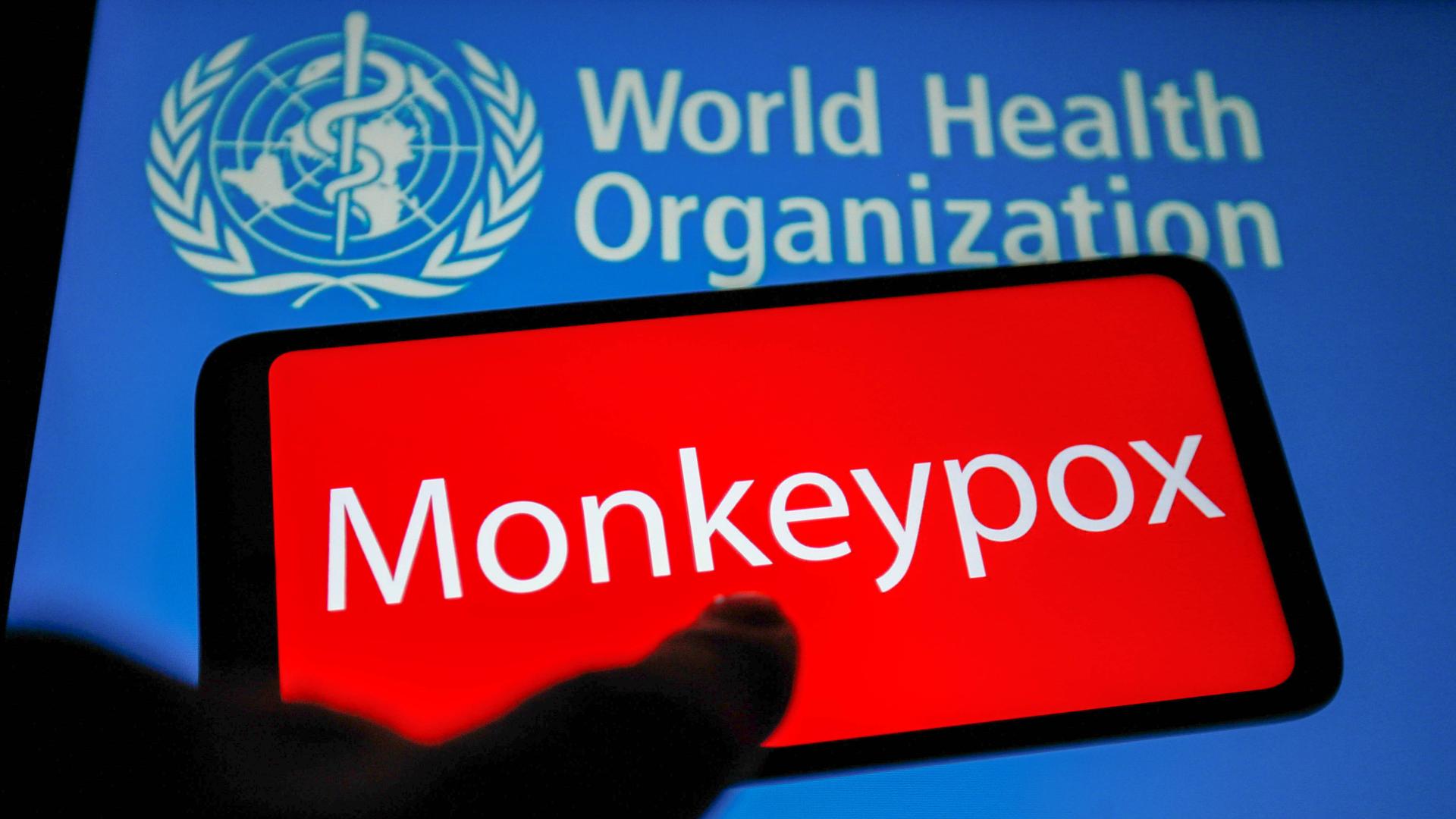 131 monkeypox cases confirmed outside Africa, WHO says 'containable' - CGTN