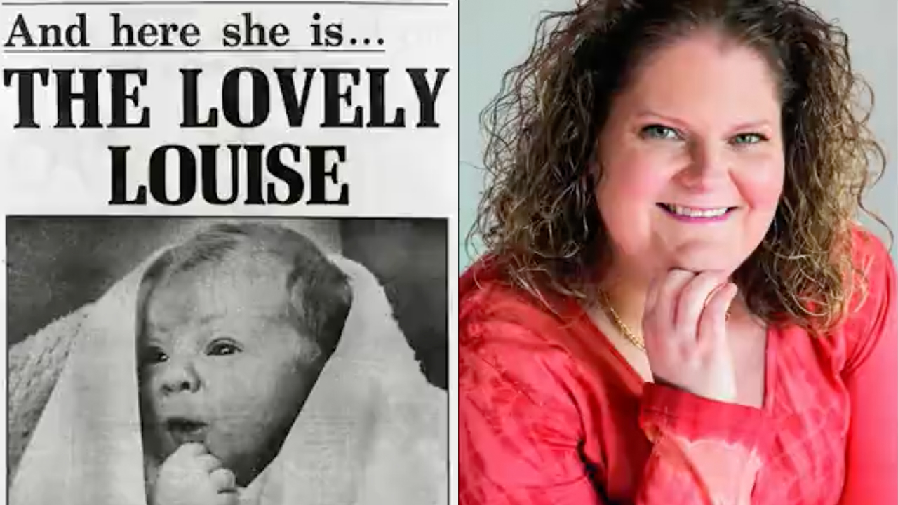 26 The Unexpected Legacy Of Louise Brown The First Ivf Baby - 3ygnmzw
