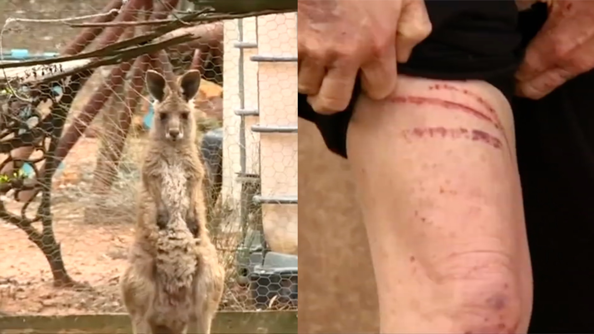 A Couple Were Seriously Wounded When They Were Attacked By A Grey Kangaroo They Escaped With