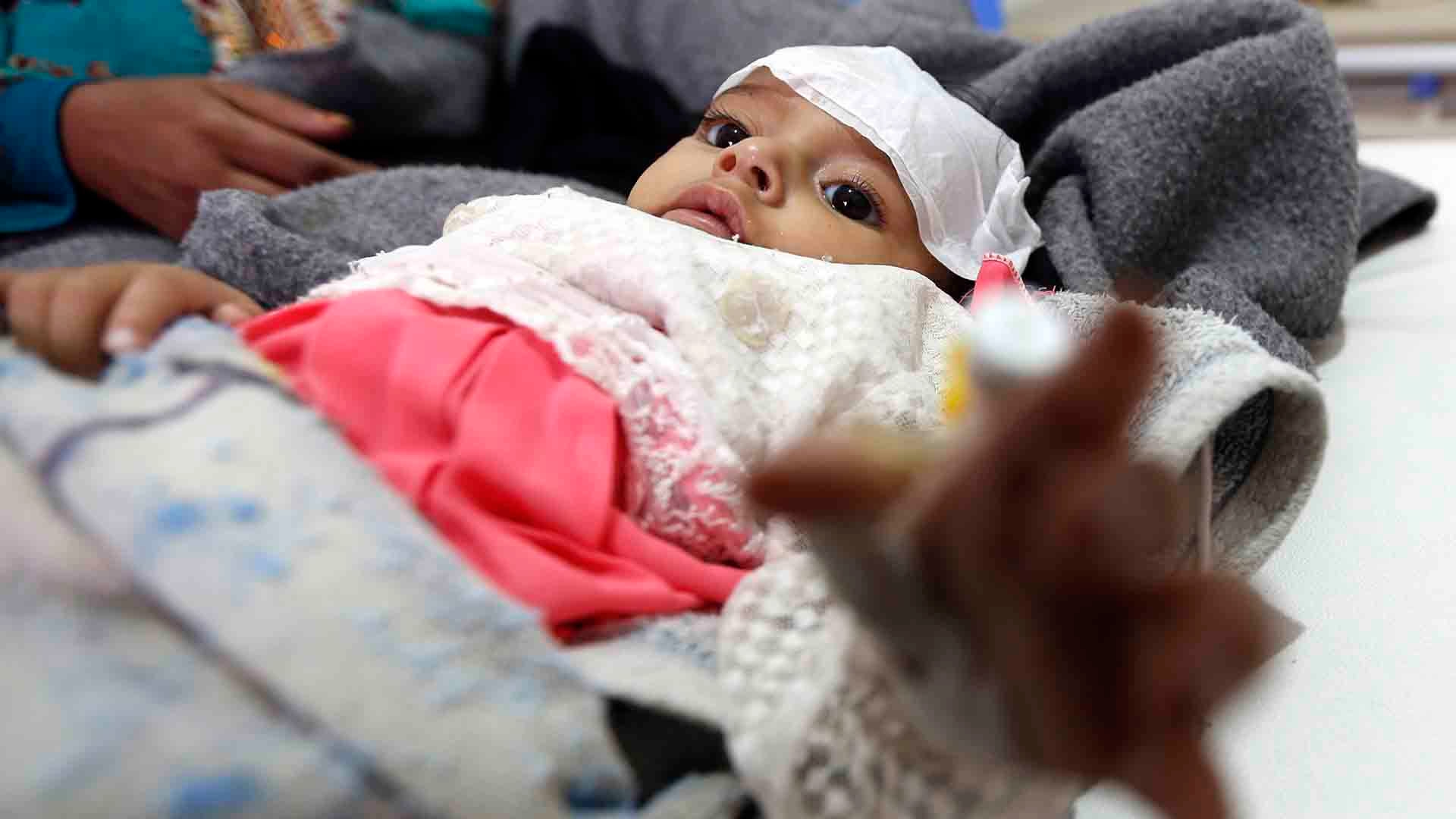 Who Death Toll Rises From Yemen Cholera Epidemic Cgtn